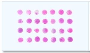 Frozen Tissue Array - 37 Different Breast Tumors and 3 Corresponding Normal Controls